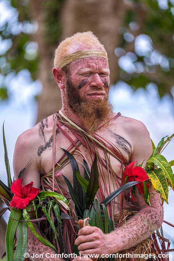 Vanua Lava Albino Man 1